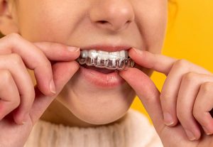 Ortodoncia | Clínica Dental Feria
